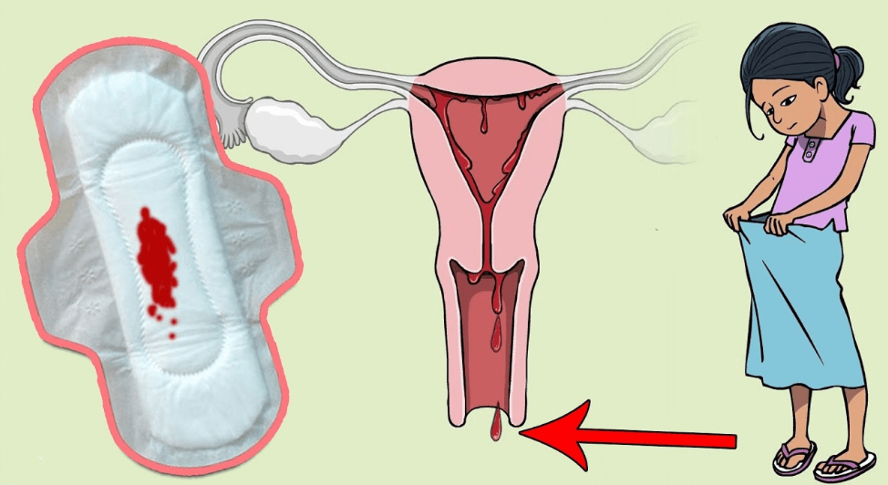 سبب نزول الدورة الشهرية , اعراض الدورة الشهرية