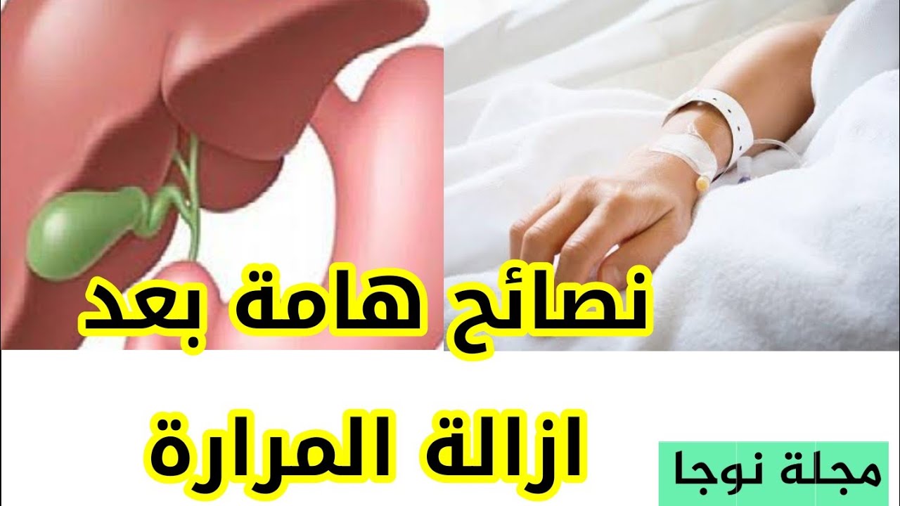 استئصال المرارة سلبياتها وايجابياتها- تعرفوا معنا على المراره 12273 4