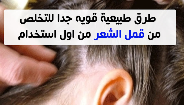 التخلص من القمل , طرق التخلص من القمل