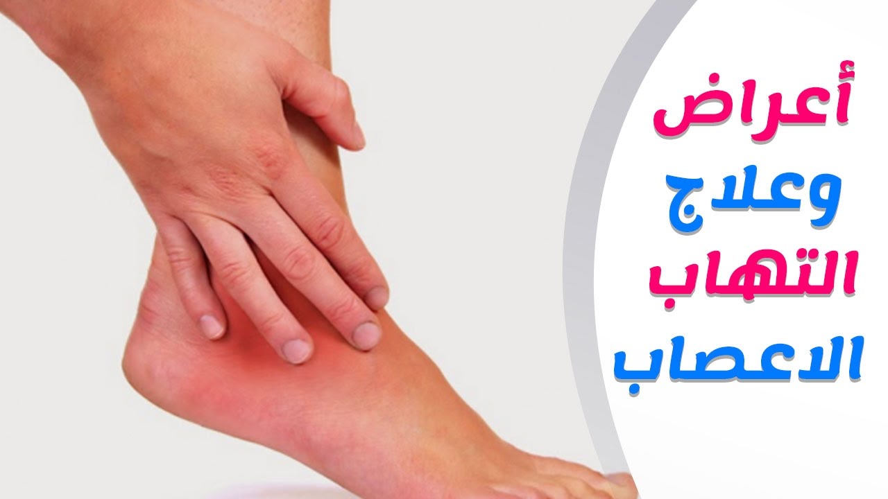 علاج الاعصاب - تشخيض وعلاج الامراض التى تصيب الاعصاب 4121