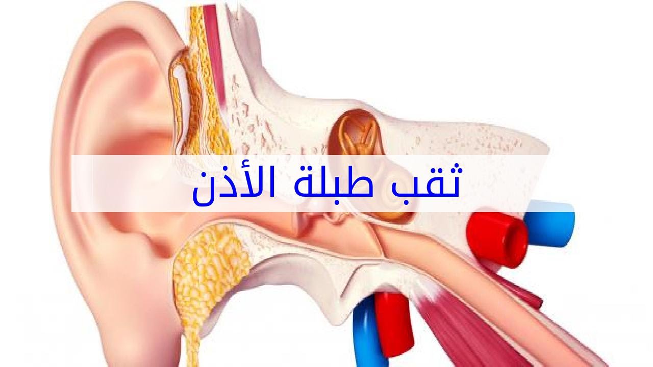 علاج التهاب الاذن - العلاج الصحيح الطبى لالتهابات الاذن 3041 1