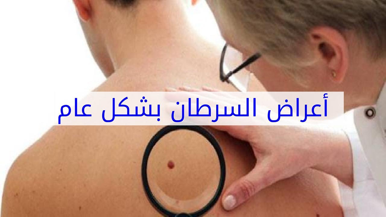 اعراض مرض السرطان , علامات تدل على الاصابة بالسرطان