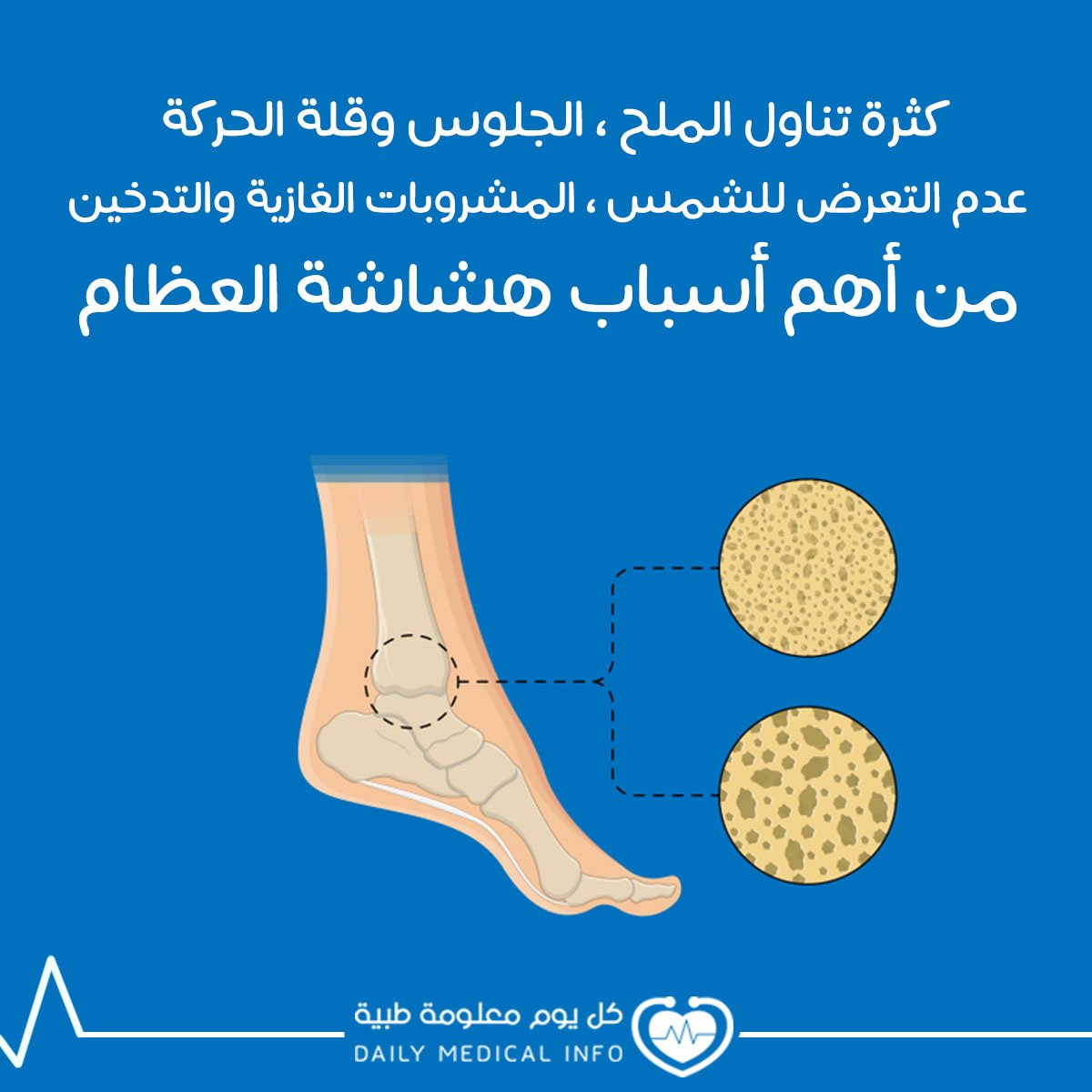 سبب هشاشة العظام , تعرفوا على الاعراض اللي بيعاني منها الجميع