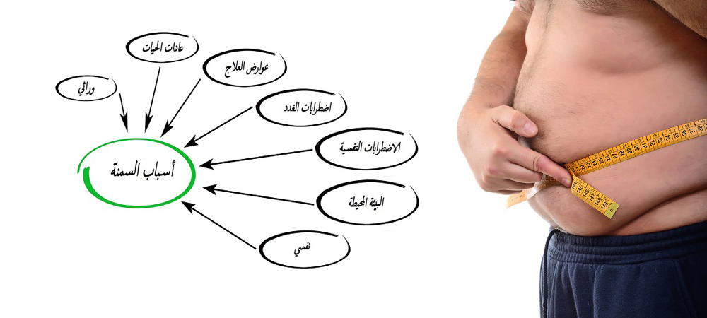 اسباب السمنة - كيفيه علاج مرض السمنه المفرطه 4879 2