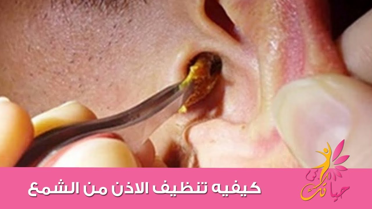 طريقة تنظيف الاذن بالصور , في اذنيك