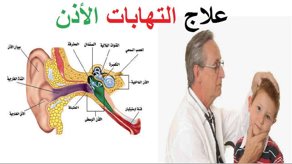 علاج التهاب الاذن - العلاج الصحيح الطبى لالتهابات الاذن 3041 2