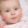 16227 1 اعراض واسباب حساسية البيض لدى الاطفال-علامات قد تظهرت على طفلك طماعه حيان